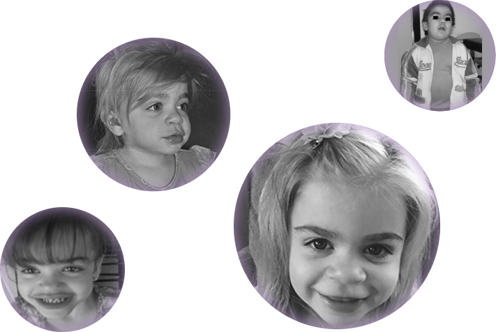 Physical features showing oral abnormalities, Chest x-ray of protuberant abdomen, Physical features showing coarse facial features, Physical features showing dolichocephaly