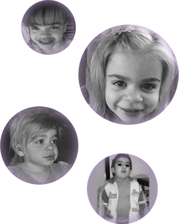 Physical features showing oral abnormalities, Chest x-ray of protuberant abdomen, Physical features showing coarse facial features, Physical features showing dolichocephaly